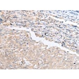 CCR4 Antibody from Signalway Antibody (43918) - Antibodies.com