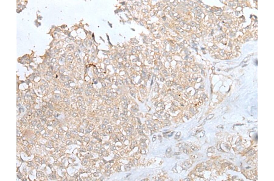 DOK6 Antibody from Signalway Antibody (43921) - Antibodies.com