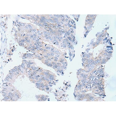 DOK2 Antibody from Signalway Antibody (43939) - Antibodies.com
