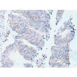 DOK2 Antibody from Signalway Antibody (43939) - Antibodies.com