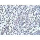 DOK2 Antibody from Signalway Antibody (43939) - Antibodies.com