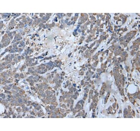 MYF6 Antibody from Signalway Antibody (43952) - Antibodies.com