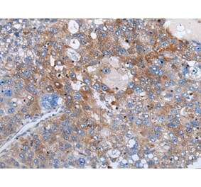 WEE2 Antibody from Signalway Antibody (43978) - Antibodies.com