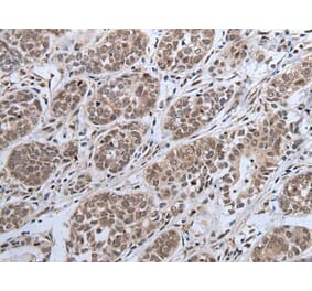 IWS1 Antibody from Signalway Antibody (43981) - Antibodies.com