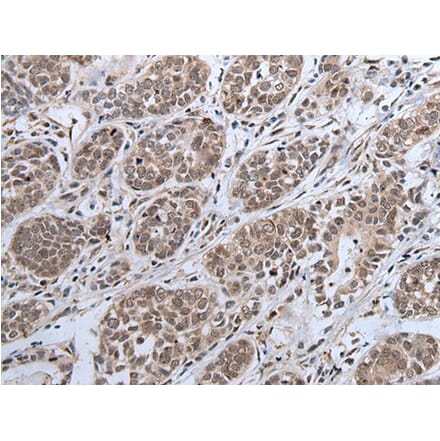 IWS1 Antibody from Signalway Antibody (43981) - Antibodies.com