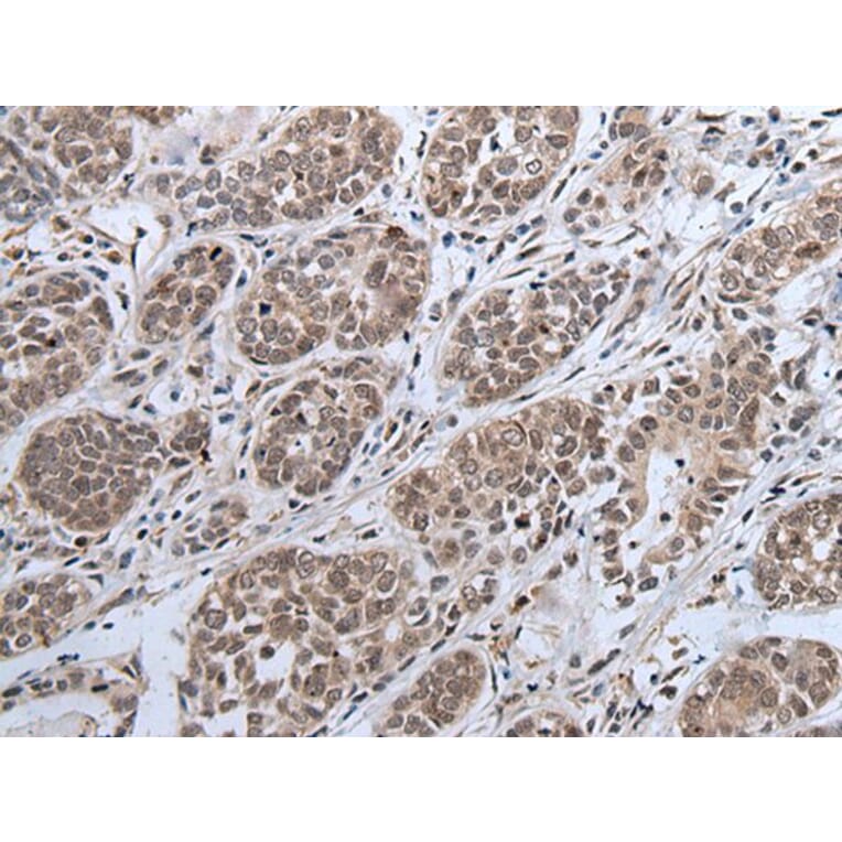 IWS1 Antibody from Signalway Antibody (43981) - Antibodies.com