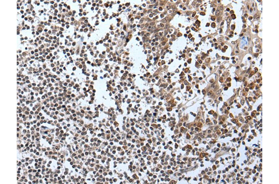 IWS1 Antibody from Signalway Antibody (43981) - Antibodies.com