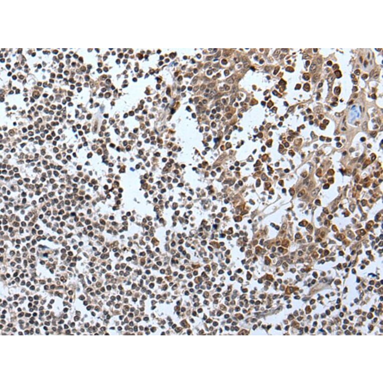 IWS1 Antibody from Signalway Antibody (43981) - Antibodies.com