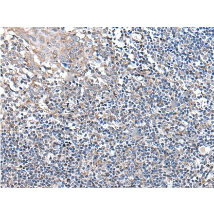 UBN2 Antibody from Signalway Antibody (43985) - Antibodies.com