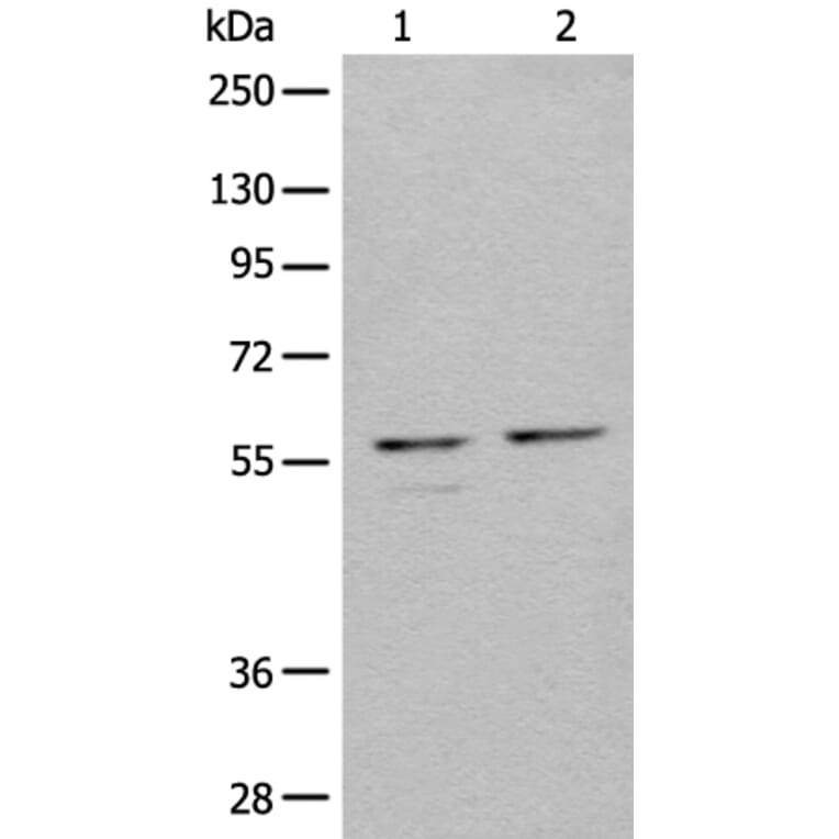 URI1 Antibody from Signalway Antibody (44002) - Antibodies.com