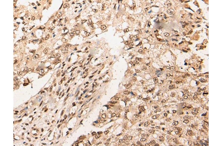 URI1 Antibody from Signalway Antibody (44002) - Antibodies.com