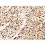 URI1 Antibody from Signalway Antibody (44002) - Antibodies.com