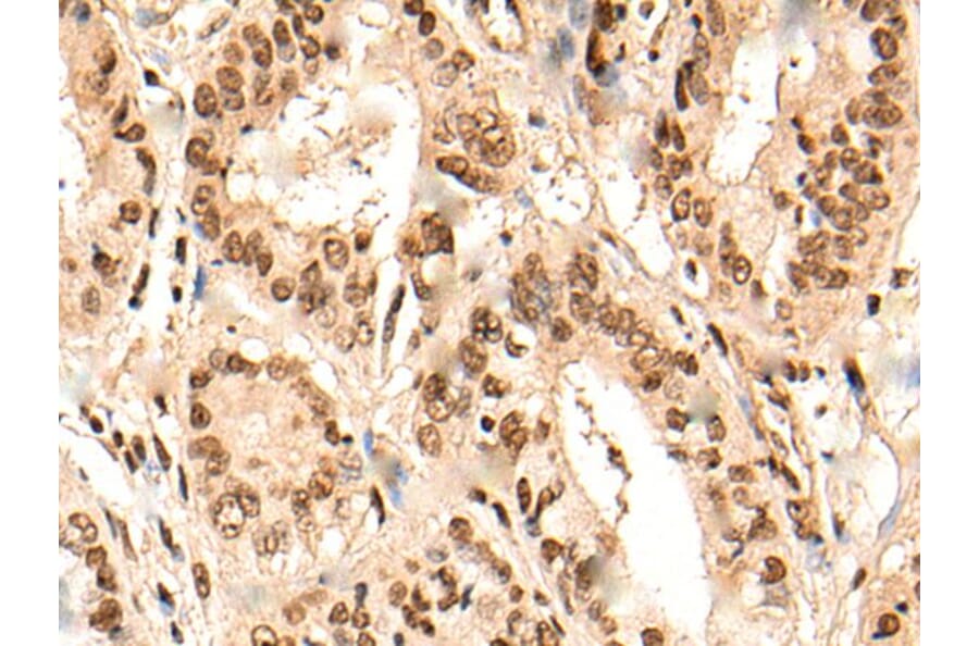 URI1 Antibody from Signalway Antibody (44002) - Antibodies.com