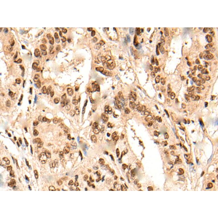 URI1 Antibody from Signalway Antibody (44002) - Antibodies.com