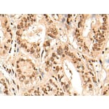 URI1 Antibody from Signalway Antibody (44002) - Antibodies.com