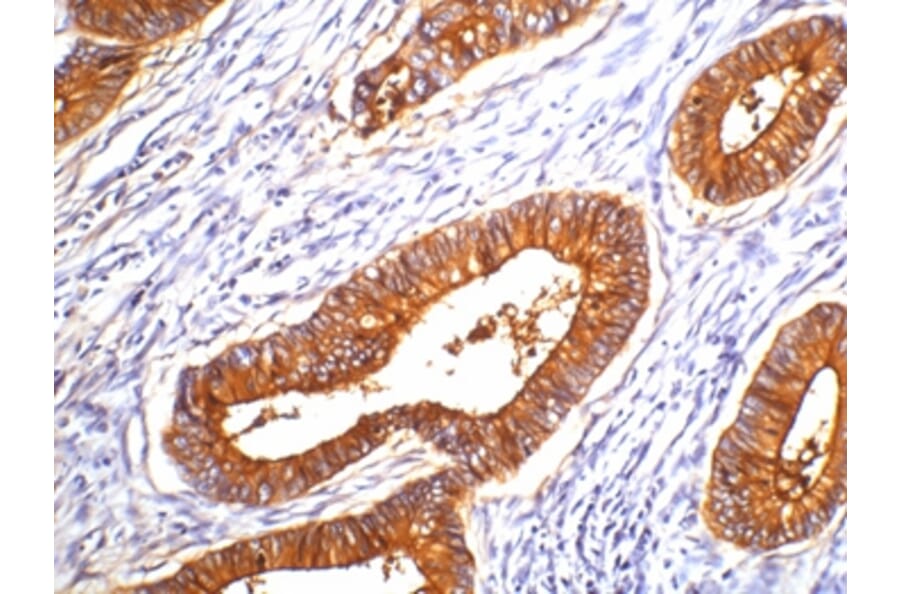 Carcinoembryonic Antigen Antibody from Signalway Antibody (38106) - Antibodies.com