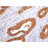 Carcinoembryonic Antigen Antibody from Signalway Antibody (38106) - Antibodies.com