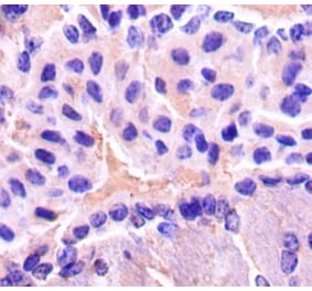 Immunohistochemistry - Gamma-enolase Polyclonal Antibody from Signalway Antibody (42511) - Antibodies.com