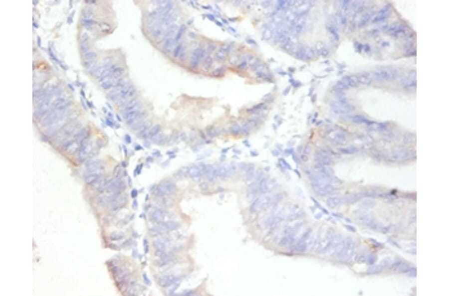 Immunohistochemistry - Antigen KI-67 Polyclonal Antibody from Signalway Antibody (42544) - Antibodies.com