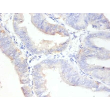 Immunohistochemistry - Antigen KI-67 Polyclonal Antibody from Signalway Antibody (42544) - Antibodies.com