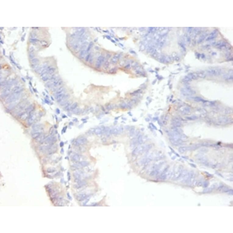 Immunohistochemistry - Antigen KI-67 Polyclonal Antibody from Signalway Antibody (42544) - Antibodies.com