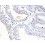 Immunohistochemistry - Antigen KI-67 Polyclonal Antibody from Signalway Antibody (42544) - Antibodies.com
