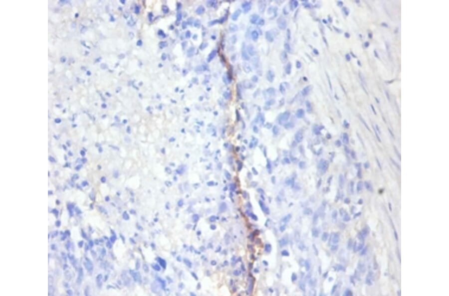 Immunohistochemistry - Antigen KI-67 Polyclonal Antibody from Signalway Antibody (42544) - Antibodies.com