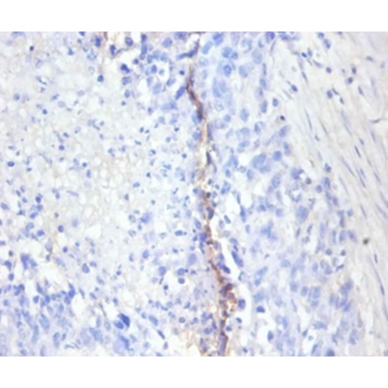 Immunohistochemistry - Antigen KI-67 Polyclonal Antibody from Signalway Antibody (42544) - Antibodies.com