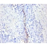 Immunohistochemistry - Antigen KI-67 Polyclonal Antibody from Signalway Antibody (42544) - Antibodies.com