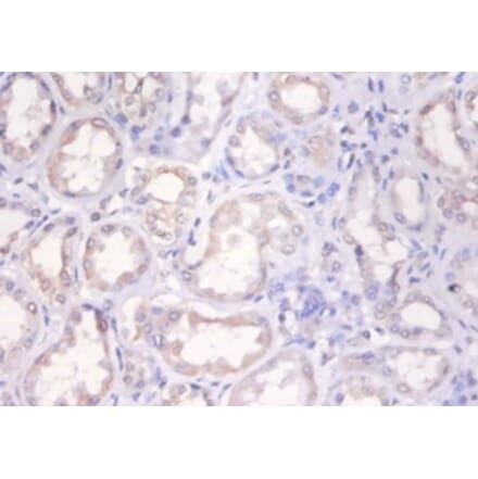 Immunohistochemistry - Histone H2A.x Polyclonal Antibody from Signalway Antibody (42593) - Antibodies.com