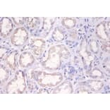 Immunohistochemistry - Histone H2A.x Polyclonal Antibody from Signalway Antibody (42593) - Antibodies.com