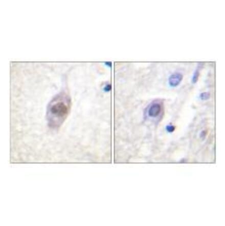 Immunohistochemistry - APC Antibody from Signalway Antibody (33153) - Antibodies.com