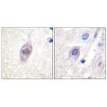 Immunohistochemistry - APC Antibody from Signalway Antibody (33153) - Antibodies.com