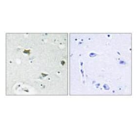 Immunohistochemistry - BAD Antibody from Signalway Antibody (33154) - Antibodies.com