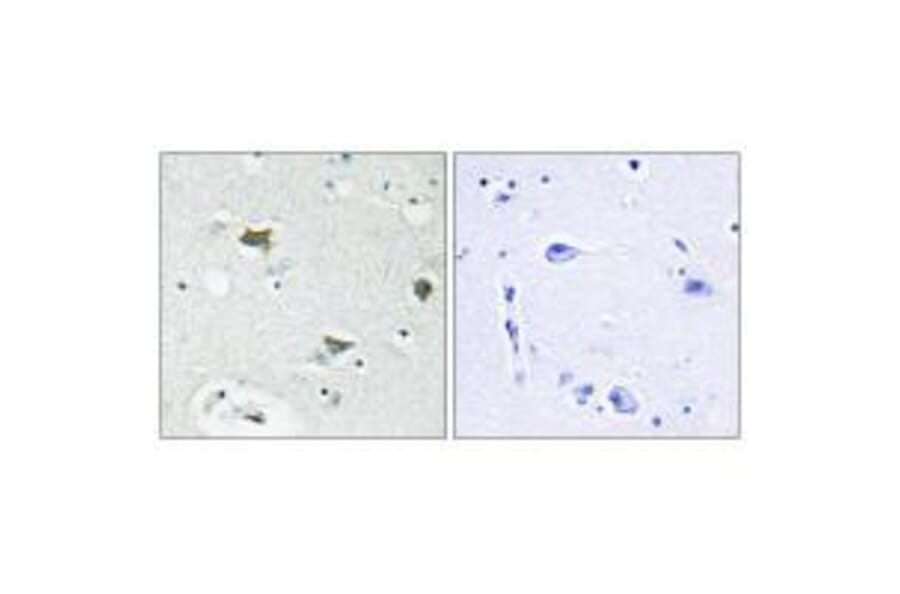Immunohistochemistry - BAD Antibody from Signalway Antibody (33154) - Antibodies.com