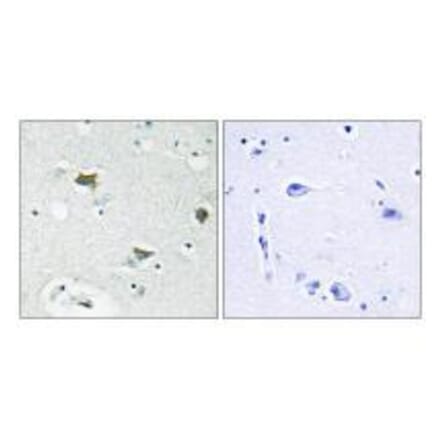 Immunohistochemistry - BAD Antibody from Signalway Antibody (33154) - Antibodies.com