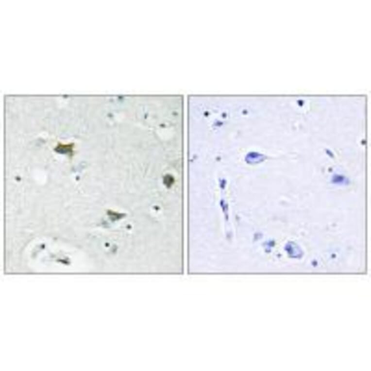 Immunohistochemistry - BAD Antibody from Signalway Antibody (33154) - Antibodies.com