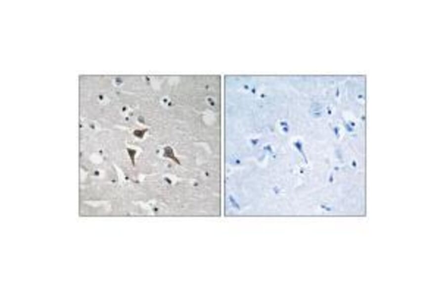 Immunohistochemistry - ALK Antibody from Signalway Antibody (33225) - Antibodies.com