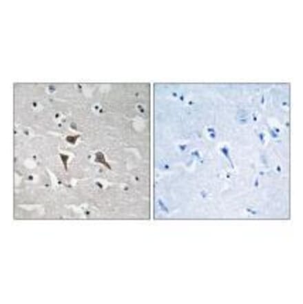 Immunohistochemistry - ALK Antibody from Signalway Antibody (33225) - Antibodies.com