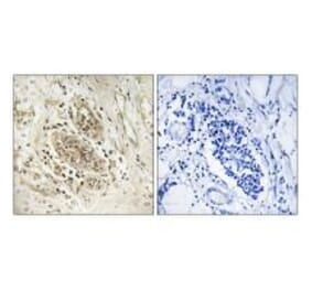 Immunohistochemistry - Myc Antibody from Signalway Antibody (34647) - Antibodies.com