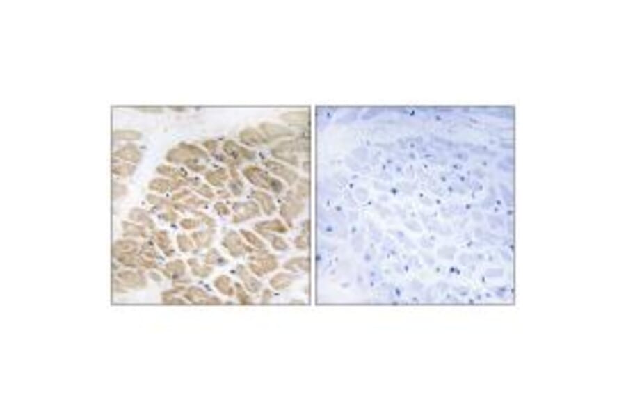 Immunohistochemistry - MIA Antibody from Signalway Antibody (34781) - Antibodies.com