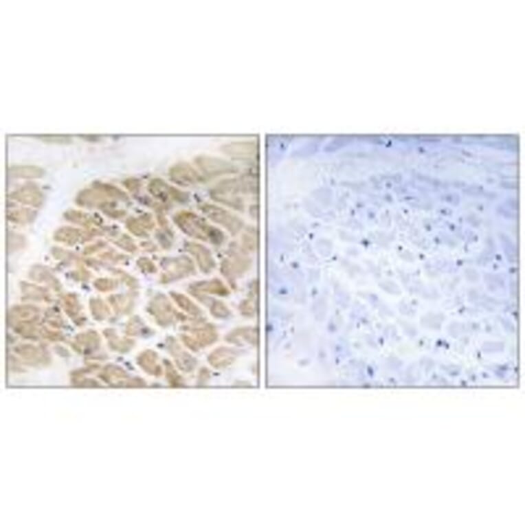 Immunohistochemistry - MIA Antibody from Signalway Antibody (34781) - Antibodies.com
