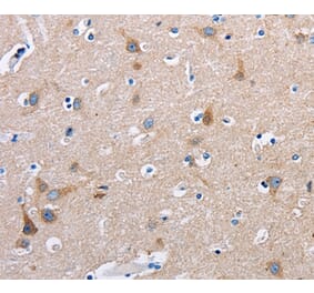 Immunohistochemistry - FN1 Antibody from Signalway Antibody (35542) - Antibodies.com