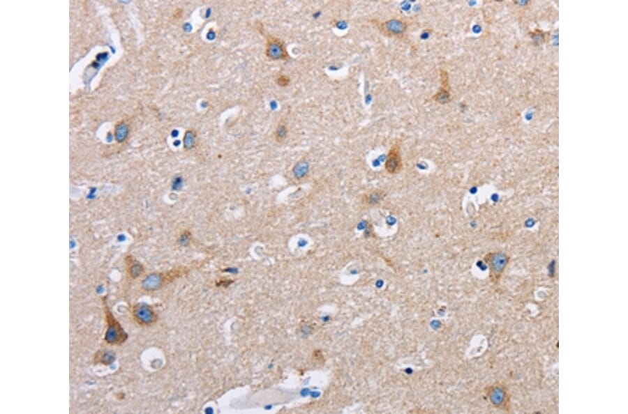Immunohistochemistry - FN1 Antibody from Signalway Antibody (35542) - Antibodies.com