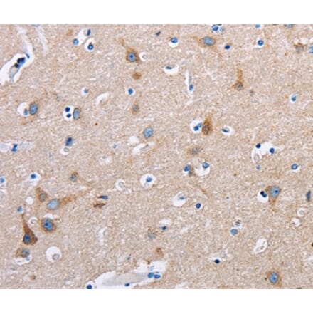 Immunohistochemistry - FN1 Antibody from Signalway Antibody (35542) - Antibodies.com