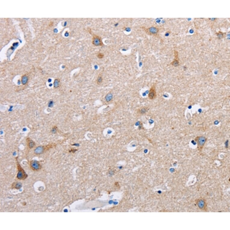 Immunohistochemistry - FN1 Antibody from Signalway Antibody (35542) - Antibodies.com