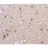 Immunohistochemistry - FN1 Antibody from Signalway Antibody (35542) - Antibodies.com