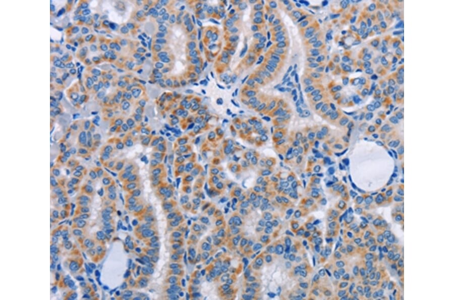 Immunohistochemistry - FN1 Antibody from Signalway Antibody (35542) - Antibodies.com