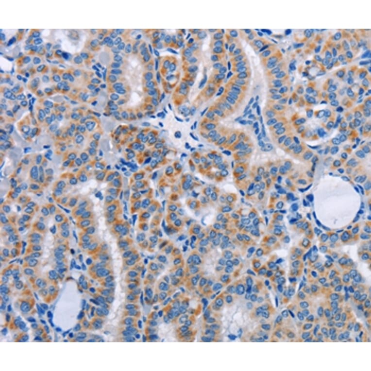 Immunohistochemistry - FN1 Antibody from Signalway Antibody (35542) - Antibodies.com