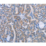 Immunohistochemistry - FN1 Antibody from Signalway Antibody (35542) - Antibodies.com